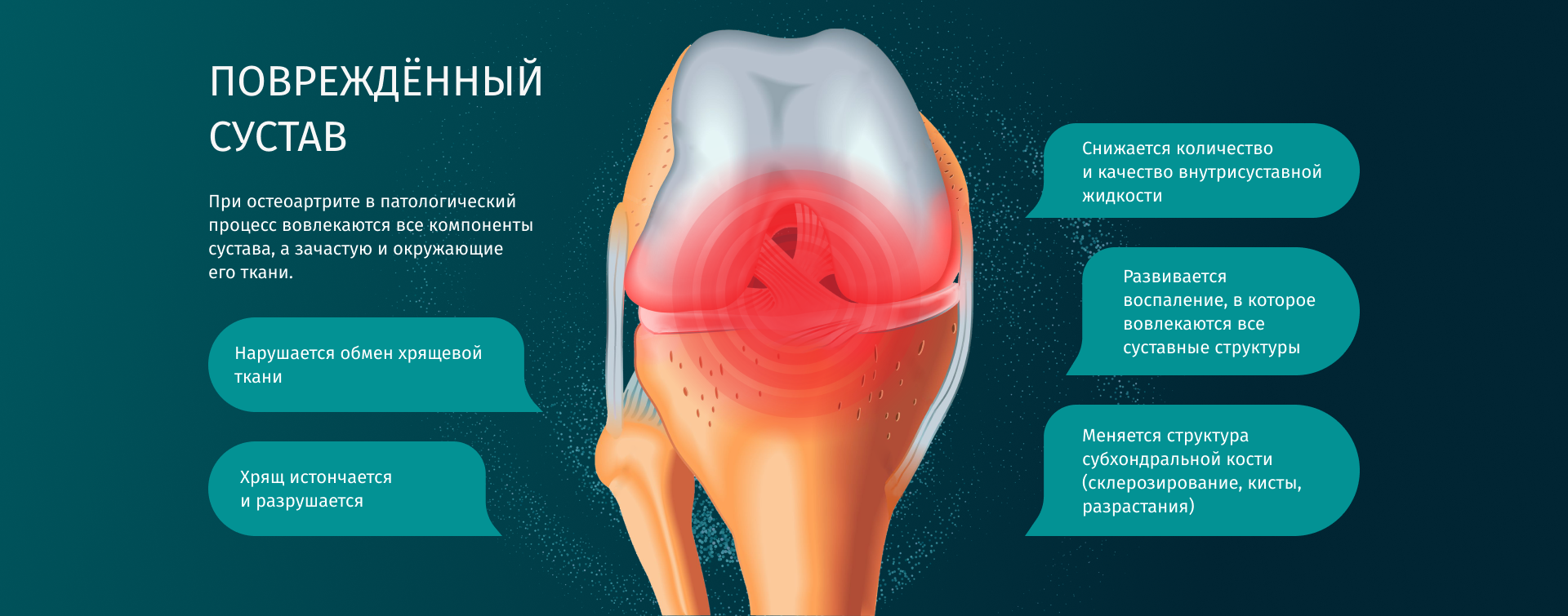 Поврежденный сустав