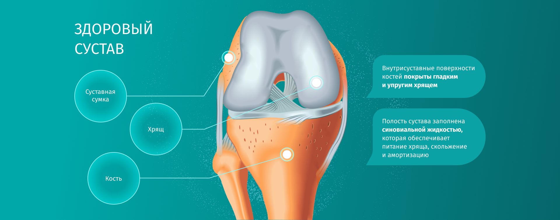 Здоровый сустав